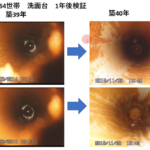 ［動画］内視鏡で実証！エルセによる剥離効果（水あか、さび、ヌメリ）